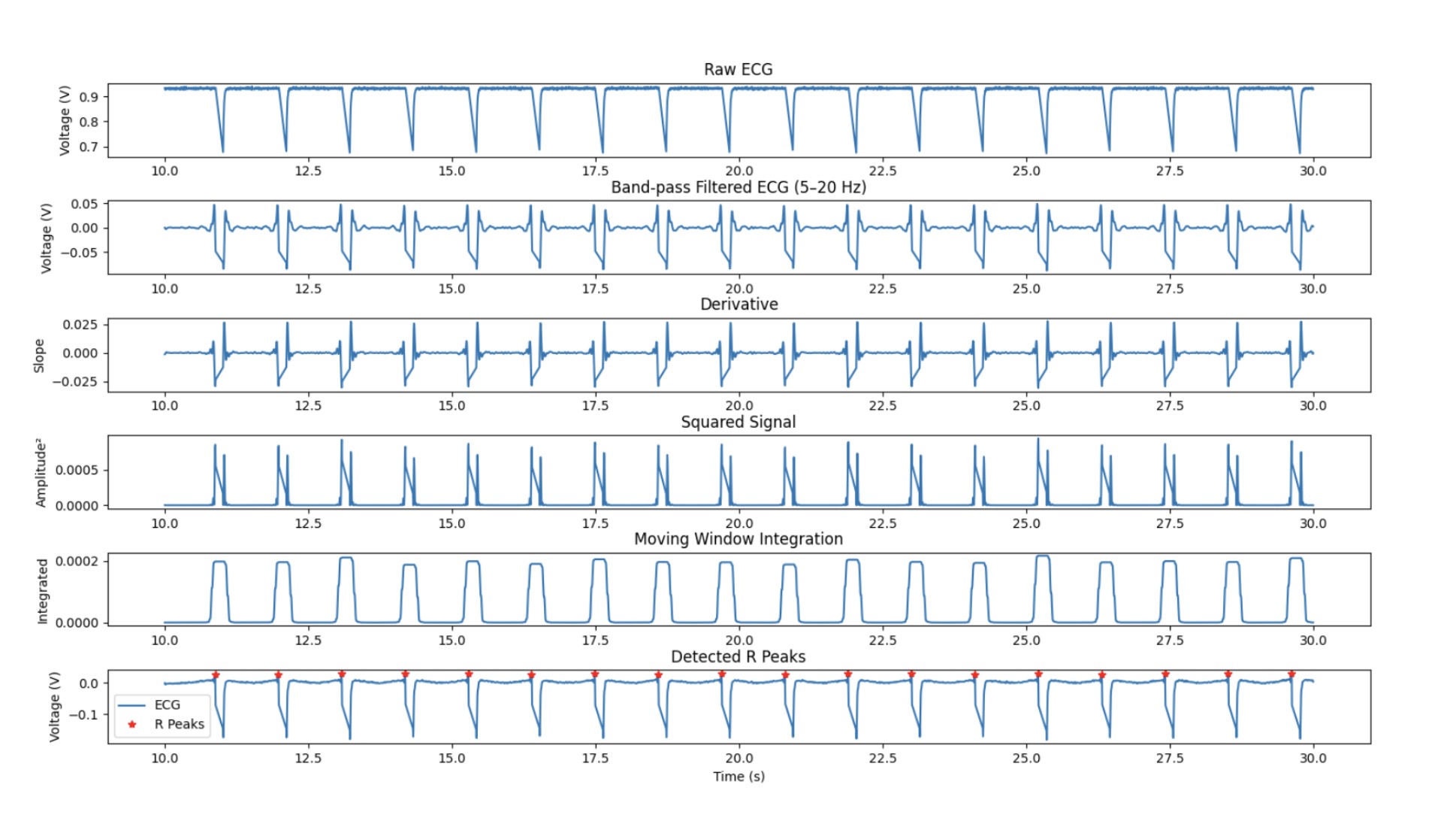ECG preprocessing steps after each Pan-Tompkins stage.